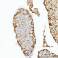 IHC staining of FFPE mouse testis tissue with GHRH antibody. HIER: boil tissue sections in pH8 EDTA for 20 min and allow to cool before testing.