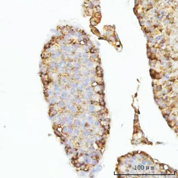 IHC staining of FFPE mouse testis tissue with GHRH antibody. HIER: boil tissue sections in pH8 EDTA for 20 min and allow to cool before testing.