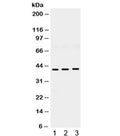 Western blot testing of 1) rat brain, 2) mouse brain and 3) human U87 lysate with HuD antibody. Expected/observed molecular weight ~42 kDa.
