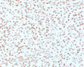 IHC testing of FFPE human pancreas with AKT1 antibody (clone RASTPK-1). HIER: boil tissue sections in pH 9 10mM Tris with 1mM EDTA for 10-20 min followed by cooling at RT for 20 min.