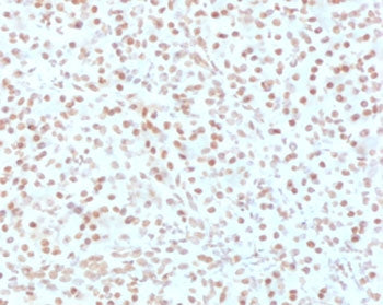IHC testing of FFPE human pancreas with AKT1 antibody (clone RASTPK-1). HIER: boil tissue sections in pH 9 10mM Tris with 1mM EDTA for 10-20 min followed by cooling at RT for 20 min.