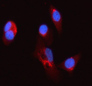 Immunofluorescent staining of SYCN using anti-SYCN antibody (red). SYCN was detected in an immunocytochemical section of PC-3 cells. Enzyme antigen retrieval was performed using IHC enzyme antigen retrieval reagent for 15 mins. The cells were blocked with 10% goat serum. And then incubated with 5 ug/ml rabbit anti-SYCN antibody overnight at 4oC. Cy3 Conjugated Goat Anti-Rabbit IgG was used as secondary antibody at 1:500 dilution and incubated for 30 min at 37oC.