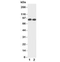 Western blot testing of TrkA antibody and Lane 1: rat brain; 2: mouse brain tissue lysate. Observed molecular weight: 85~140 kDa depending on glycosylation level.