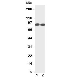 Western blot testing of TrkA antibody and Lane 1: rat brain; 2: mouse brain tissue lysate. Observed molecular weight: 85~140 kDa depending on glycosylation level.