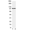 Western blot testing of EPB41L1 antibody and Lane 1: rat brain; 2: mouse brain lysate. Predicted/observed size ~99KD
