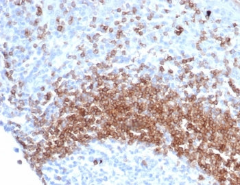 IHC staining of FFPE human tonsil tissue with recombinant IgD antibody (clone IGHD/6818R). Inset: PBS used in place of primary Ab (secondary Ab negative control). HIER: boil tissue sections in pH 9 10mM Tris with 1mM EDTA for 20 min and allow to cool before testing.