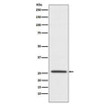 Western blot testing of human SH-SY5Y cell lysate with Claudin 11 antibody. Predicted molecular weight ~22 kDa.