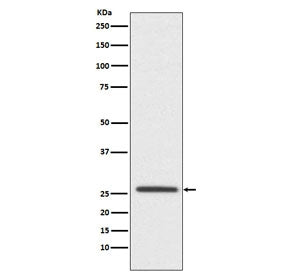Western blot testing of human SH-SY5Y cell lysate with Claudin 11 antibody. Predicted molecular weight ~22 kDa.
