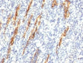 IHC: Formalin-fixed, paraffin-embedded human tonsil stained with CD34 antibody (QBEnd/10 + HPCA1/763)