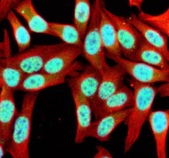 Immunofluorescent staining of SIK1 using anti-SIK1 antibody (green) and anti-Beta Tubulin antibody (red). SIK1 was detected in an immunocytochemical section of Hela cells. Enzyme antigen retrieval was performed using IHC enzyme antigen retrieval reagent for 15 mins. The cells were blocked with 10% goat serum. And then incubated with 5 ug/ml rabbit anti-SIK1 antibody and mouse anti-Beta Tubulin antibody overnight at 4oC.