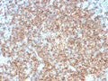 IHC testing of FFPE human tonsil tissue with CD22 antibody (clone BLCAM/1795). HIER: boil tissue sections in 10mM citrate buffer, pH 6, for 10-20 min followed by cooling at RT for 20 min.