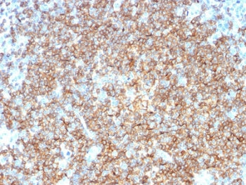 IHC testing of FFPE human tonsil tissue with CD22 antibody (clone BLCAM/1795). HIER: boil tissue sections in 10mM citrate buffer, pH 6, for 10-20 min followed by cooling at RT for 20 min.