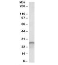 Western blot testing of human cerebellum lysate with Calbindin 1 antibody at 0.03ug/ml. Predicted molecular weight: ~30 kDa, routinely observed at 27-28 kDa.