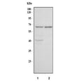 Western blot testing of human 1) RT4 and 2) U-251 cell lysate with MANSC1 antibody. Predicted molecular weight ~47 kDa but may be observed at higher molecular weights due to glycosylation.