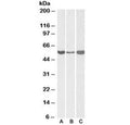 Western blot testing of human [A] and mouse [B] liver, and rat [C] testis lysate with ALDH1A1 antibody at 0.3ug/ml. Predicted molecular weight ~55 kDa.