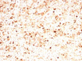 IHC staining of FFPE human spleen tissue with MPO antibody (clone rMPO/8694). HIER: boil tissue sections in pH 9 10mM Tris with 1mM EDTA for 20 min and allow to cool before testing.