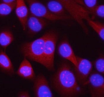 Immunofluorescent staining of RPL14 using anti-RPL14 antibody (red). RPL14 was detected in an immunocytochemical section of HELA cells. Enzyme antigen retrieval was performed using IHC enzyme antigen retrieval reagent for 15 mins. The cells were blocked with 10% goat serum. And then incubated with 5 ug/ml rabbit anti-RPL14 antibody overnight at 4oC. Cy3 Conjugated Goat Anti-Rabbit IgG was used as secondary antibody at 1:500 dilution and incubated for 30 min at 37oC.