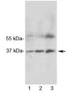 Western blot testing of 1) rat heart, 2) rat skeletal muscle and 3) human MCF7 lysate with MRGX1 antibody. Expected molecular weight ~37 kDa.