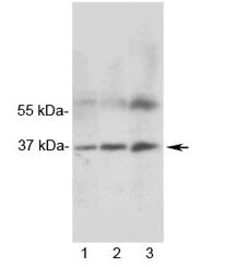 Western blot testing of 1) rat heart, 2) rat skeletal muscle and 3) human MCF7 lysate with MRGX1 antibody. Expected molecular weight ~37 kDa.