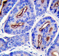 PSMA antibody immunohistochemistry analysis in formalin fixed and paraffin embedded human prostate carcinoma.