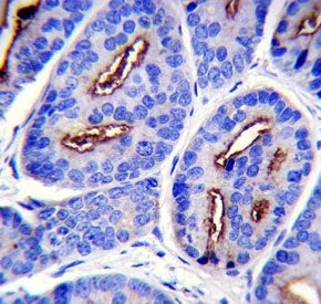 PSMA antibody immunohistochemistry analysis in formalin fixed and paraffin embedded human prostate carcinoma.