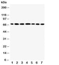 Western blot testing of DDX5 antibody and Lane 1: rat testis; 2: mouse testis; 3: human HeLa; 4: (h) MCF-7; 5: (m) NIH3T3; 6: (h) SKOV; 7: (h) MM231. Predicted/observed molecular weight: ~68kDa.