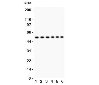 Western blot testing of CD8 antibody and Lane 1: Jurkat; 2: Raji; 3: HL-60; 4: A549; 5: COLO320; 6: HeLa lysate; Predicted molecular weight ~34 kDa; Observed molecular weight: 34~60 kDa depending on glycosylation level.