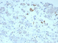 IHC staining of FFPE human adrenal gland tissue with IL-6 antibody (clone IL6/8713). HIER: boil tissue sections in pH 9 10mM Tris with 1mM EDTA for 20 min and allow to cool before testing.