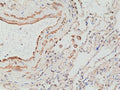 IHC staining of FFPE human lung tissue with recombinant MMP12 antibody at 1:2500.