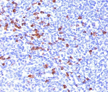 IHC testing of human tonsil stained with anti-IgG antibody (IG266). HIER: boil tissue sections in 10mM citrate buffer, pH 6, for 10-20 min and allow to cool before testing.