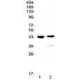 Western blot testing of 1) mouse testis and 2) rat testis lysate with Cathepsin D / CTSD antibody at 0.5ug/ml. Expected molecular weight: 43-46 kDa, 28 kDa (heavy chain), 15 kDa (light chain).