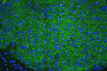 Immunofluorescent staining of FFPE mouse brain tissue with Tyrosine Hydroxylase antibody (green) and DAPI nuclear stain (blue). HIER: steam section in pH8 EDTA buffer for 20 min.
