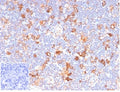 IHC staining of FFPE human lymph node tissue with recombinant CD86 antibody (clone C86/6500R). Negative control inset: PBS used instead of primary antibody to control for secondary Ab binding. HIER: boil tissue sections in pH 9 10mM Tris with 1mM EDTA for 20 min and allow to cool before testing.