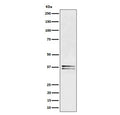 Western blot testing of human Jurkat cell lysate with LAT antibody. Expected molecular weight: 36-38 kDa.
