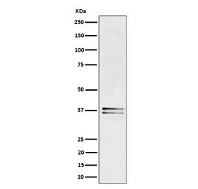 Western blot testing of human Jurkat cell lysate with LAT antibody. Expected molecular weight: 36-38 kDa.