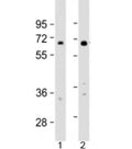 Western blot testing of human 1) HeLa and 2) HT-1080 cell lysate with IL4I1 antibody at 1:2000. Predicted molecular weight: 63 kDa.
