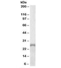 Western blot testing of human adrenal gland lysate with PHOX2A antibody at 1ug/ml. Predicted molecular weight: ~30kDa.