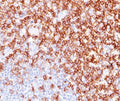 IHC testing of human tonsil stained with CD45RO antibody (UCHL-1).