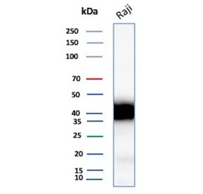 Western blot testing of human Raji cell lysate with recombinant CD48 antibody. Expected molecular weight: 28-50 kDa depending on glycosylation level.