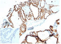 IHC staining of FFPE human thyroid tissue with recombinant CDH16 antibody (clone CHD16/7027R) at 2ug/ml in PBS for 30min RT. Negative control inset: PBS used instead of primary antibody to control for secondary Ab binding. HIER: boil tissue sections in pH 9 10mM Tris with 1mM EDTA for 20 min and allow to cool before testing.