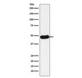 Western blot testing of human lung adenocarcinoma lysate with Napsin A antibody. Expected molecular weight: 38-45 kDa depending on glycosylation level.