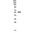 Western blot testing of human SW579 lysate with FGR antibody at 0.5ug/ml. Predicted molecular weight: ~59 kDa, routinely observed at 55~59 kDa.