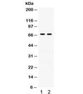 Western blot testing of human 1) A431 and 2) A549 lysate with Involucrin antibody. Predicted molecular weight ~68 kDa but can be observed at up to ~140 kDa.
