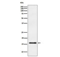 Western blot testing of human fetal brain lysate with Gamma Synuclein antibody. Expected molecular weight: 13-17 kDa.