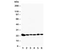 Western blot testing of Peroxiredoxin 2 antibody and Lane 1: rat brain; 2: rat kidney; 3: HeLa; 4: Jurkat; 5: 293T; 6: A549 cell lysate. Expected size: 23KD