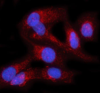 Immunofluorescent staining of PRAG1 using anti-PRAG1 antibody (red). PRAG1 was detected in an immunocytochemical section of human HELA cells. Enzyme antigen retrieval was performed using IHC enzyme antigen retrieval reagent for 15 mins. The cells were blocked with 10% goat serum. And then incubated with 5 ug/ml rabbit anti-PRAG1 antibody overnight at 4oC. Cy3 Conjugated Goat Anti-Rabbit IgG was used as secondary antibody at 1:500 dilution and incubated for 30 min at 37oC.