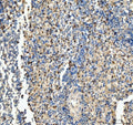 IHC staining of FFPE human spleen tissue with CD63 antibody. HIER: boil tissue sections in pH8 EDTA for 20 min and allow to cool before testing.