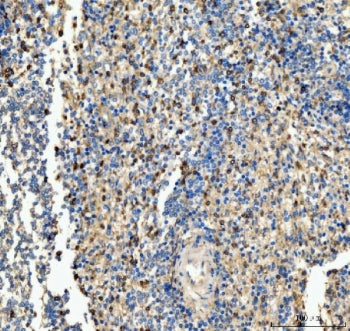 IHC staining of FFPE human spleen tissue with CD63 antibody. HIER: boil tissue sections in pH8 EDTA for 20 min and allow to cool before testing.