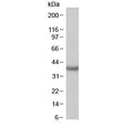Western blot testing of human kidney with SIRT4 antibody at 1ug/ml. Predicted molecular weight: ~35 kDa.
