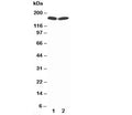 Western blot testing of nNOS antibody and Lane 1: rat brain lysate; 2: human MCF-7 lysate; Predicted molecular weight ~160 kDa.